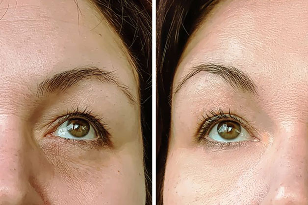 Chỉ với một thìa dầu ô liu vào mỗi buổi sáng sẽ mang tới hiệu quả bất ngờ