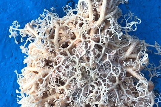 Đang đi câu cá thì bắt phải con "quái vật" lúc nhúc, anh ngư dân vội mang hỏi khắp nơi còn dân mạng đồn đoán đủ thứ