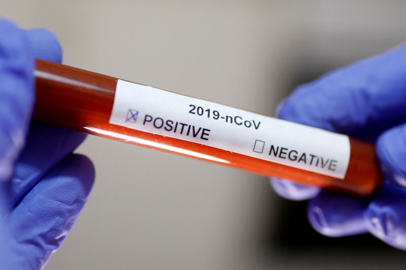 Tiền Giang: Sau khi đi viếng đám tang, 21 người dương tính với SARS-CoV-2