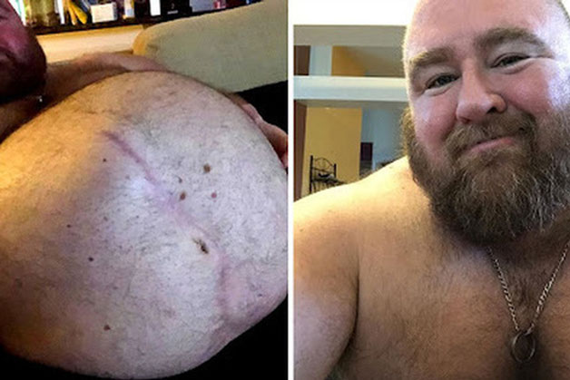 Người đàn ông nặng 225kg được dân mạng trả tiền để ăn 10 nghìn calo mỗi ngày, tuyên bố càng nhiều follow thì ăn càng khỏe