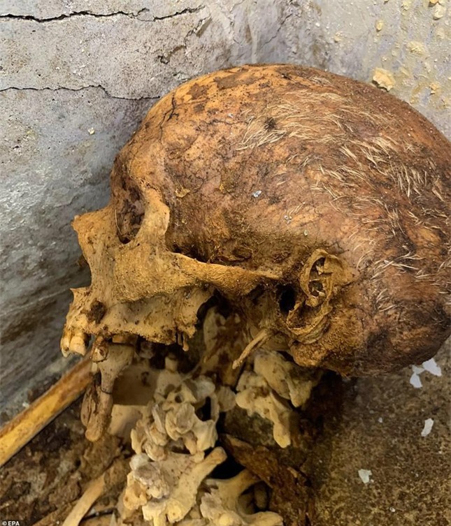 Điều gì khiến hài cốt 2000 năm tuổi ở Italia vẫn còn nguyên vẹn tóc? ảnh 2