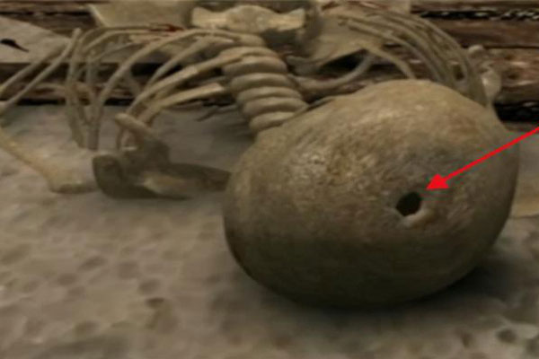 Khai quật ngôi mộ trải vàng ở vùng Tân Cương, đội khảo cổ ngỡ ngàng khi thấy thi hài chủ mộ: Thủng một lỗ giữa sọ!