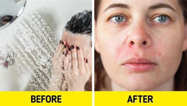 Tại sao không nên rửa mặt khi tắm vòi hoa sen? - Ảnh 5.