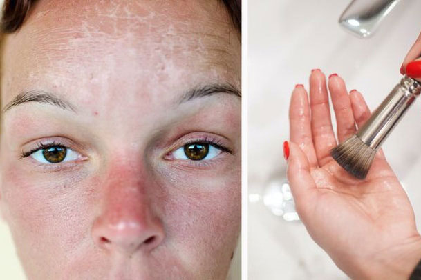 7 điều nguy hiểm cần tránh khi da của bạn bị cháy nắng