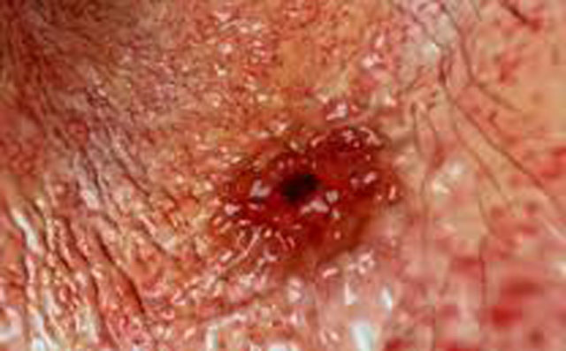 Để giảm đau dạ dày, cả nhà nên chuẩn bị bài thuốc này