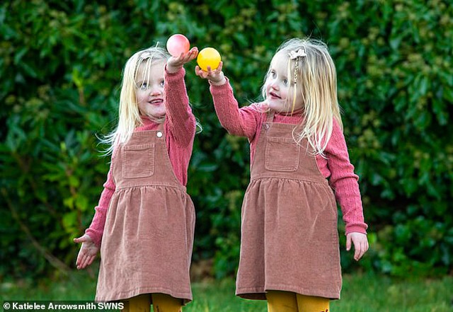 Kỳ lạ cặp song sinh giống hệt nhau nhưng làm mọi thứ ngược nhau, mỗi người thuận một tay