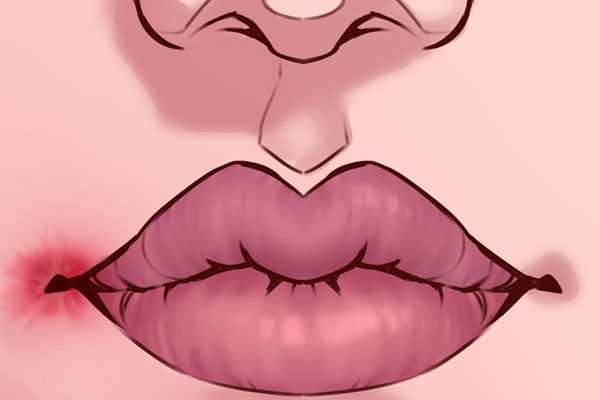 8 dấu hiệu trên môi cảnh báo vấn đề về sức khỏe, đừng bỏ qua dù chỉ là một đốm đen