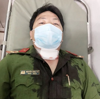 Đại úy Nguyễn Công Tín với vết thương ở cổ.
