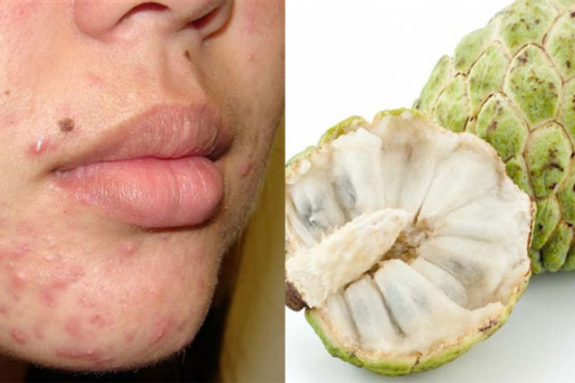 Mùa na chín rộ, ăn bổ nhưng 4 nhóm người này nên nói không