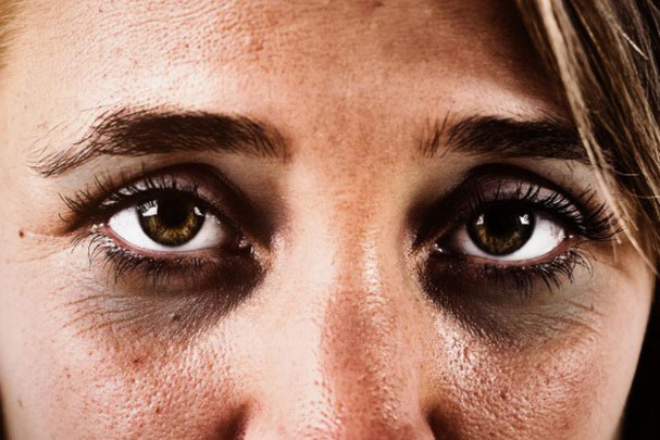 Trên mặt có 4 thứ này thâm đen cảnh báo bệnh nguy hiểm, có 1 cũng nên đi khám