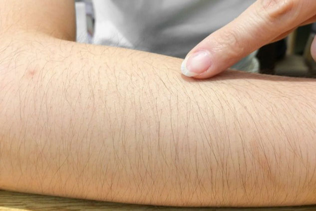 Tình trạng rậm lông ở phụ nữ: Nguyên nhân và biện pháp khắc phục