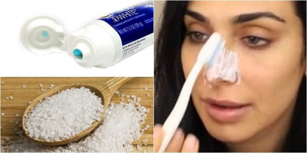 Cách trị mụn đầu đen, thâm mụn bằng kem đánh răng tại nhà cực hiệu quả