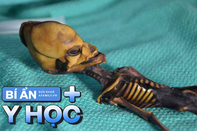 Bí ẩn về "xác ướp ngoài hành tinh" dài 13cm ở sa mạc khô nhất thế giới: 18 năm sau mới phát hiện sự thật đầy đau lòng