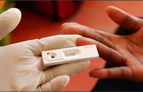 Vì sao giá kit test nhanh ngược với hướng dẫn của Bộ Y tế?