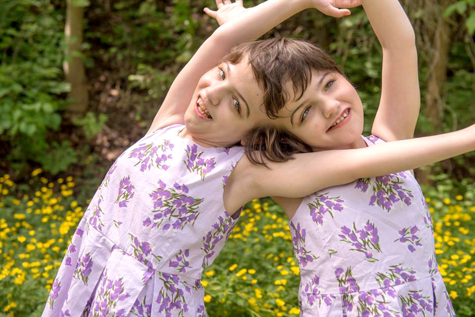 Song sinh dính liền - Những câu chuyện ít ai được biết