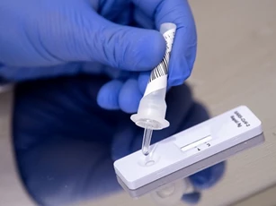 Test nhanh COVID -19 không thuộc danh mục hàng hóa, dịch vụ thực hiện bình ổn giá