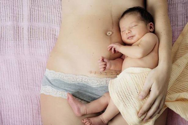 11 ki&#xEA;ng c&#x1EEF; sau sinh m&#x1ED5; kh&#xF4;ng ph&#x1EA3;i m&#x1EB9; n&#xE0;o c&#x169;ng bi&#x1EBF;t