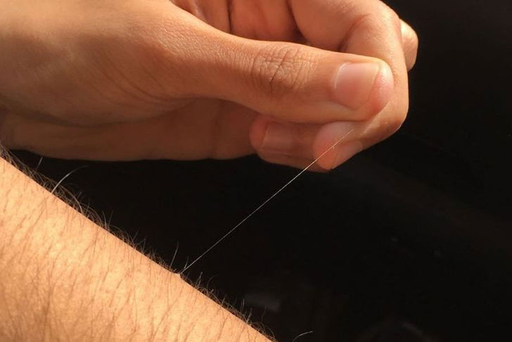 Vì sao trên cơ thể chúng ta thường xuất hiện một số sợi lông siêu dài?