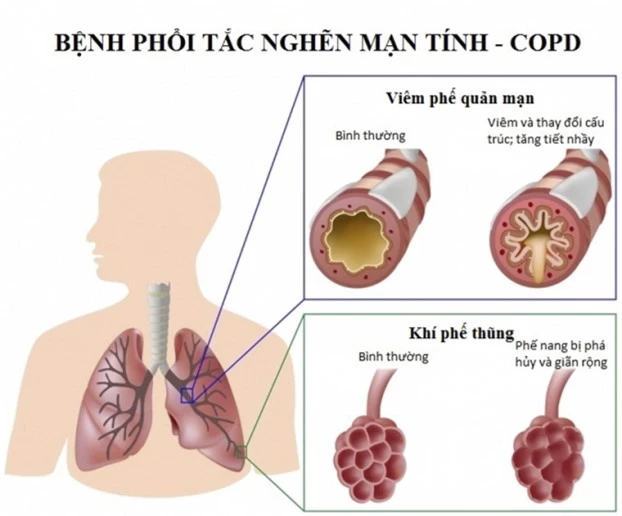 15 lý do khiến bạn chán ăn dù trước đó ăn gì cũng thấy ngon 5