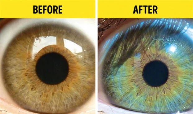5 điều kỳ lạ có thể làm thay đổi màu mắt của bạn 2