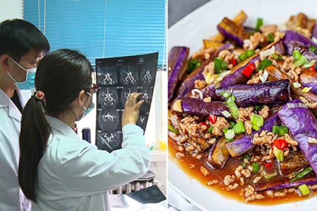 7 thực phẩm màu tím bổ hơn nhân sâm: Giúp tăng cường miễn dịch, chống oxy hóa, bảo vệ mạch máu