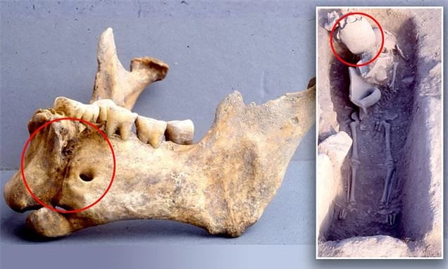 Hộp sọ chiến binh thế kỷ 14 được tìm thấy với sợi chỉ vàng bên trong, các chuyên gia thốt lên: Kỹ thuật rất cao siêu! - Ảnh 3.