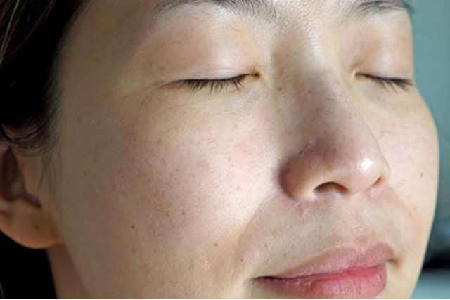 Đánh bay nám tàn nhang nhờ loại lá quen thuộc này giúp chị em tự tin khoe sắc