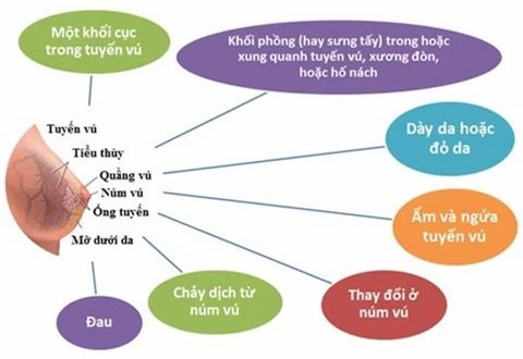 Các dấu hiệu nhận biết ung thư vú mà các chị em có thể tự kiểm tra tại nhà