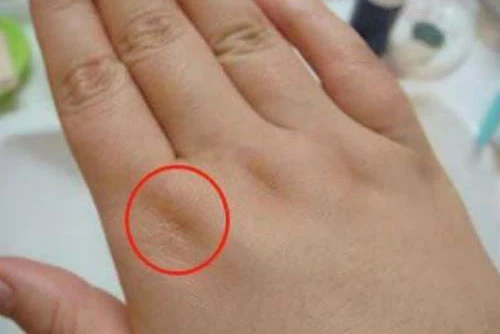 Vết lõm dưới đốt ngón tay báo hiệu may mắn, phú quý. Vết lõm dưới đốt ngón tay báo hiệu may mắn, phú quý.