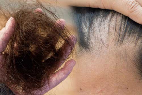 Không phân biệt nam nữ, cơ thể xuất hiện 4 dấu hiệu lạ ngầm cảnh báo thận đang bắt đầu lão hóa