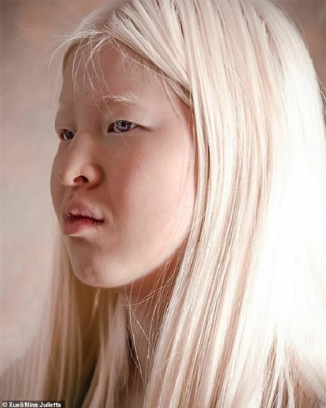 Vẻ đẹp kỳ lạ của người mẫu bạch tạng vốn là bé gái bị cha mẹ vứt bỏ - 3