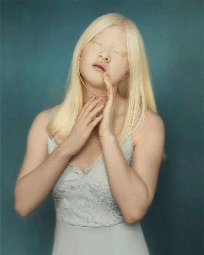 Vẻ đẹp kỳ lạ của người mẫu bạch tạng vốn là bé gái bị cha mẹ vứt bỏ - 8