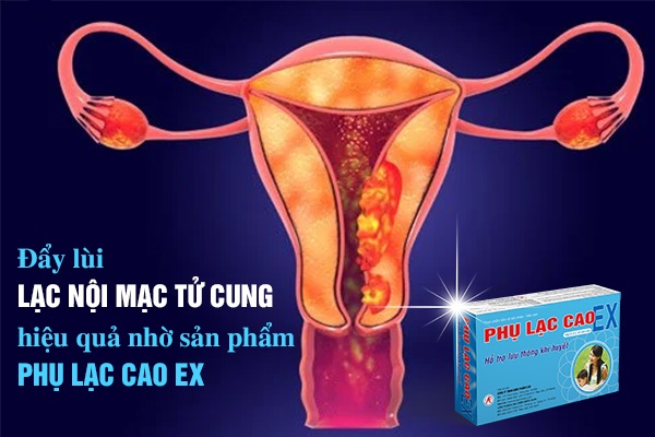 Đẩy lùi lạc nội mạc tử cung hiệu quả nhờ sản phẩm Phụ Lạc Cao EX