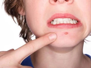 Bốn triệu chứng cho thấy độc tố trong cơ thể bạn quá cao