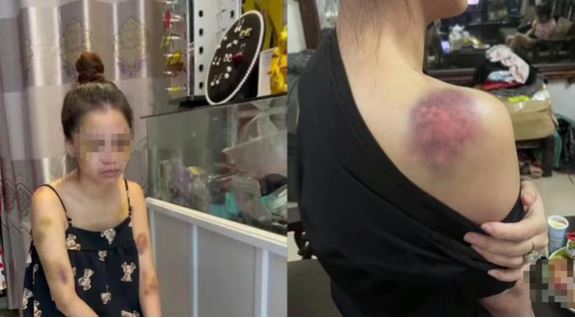 Công an truy tìm người đàn ông đánh vợ bầm dập