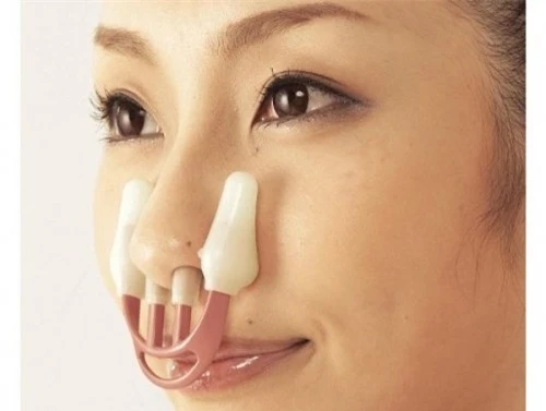 Phẫu thuật thẩm mỹ là biện pháp duy nhất thay đổi cơ trên mũi