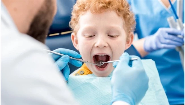 Sâu răng ở trẻ em là gì? Điều trị sâu răng ở trẻ em bằng cách nào? - Ảnh 2.