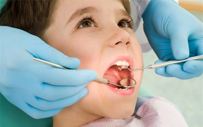 Sâu răng ở trẻ em là gì? Điều trị sâu răng ở trẻ em bằng cách nào? - Ảnh 4.