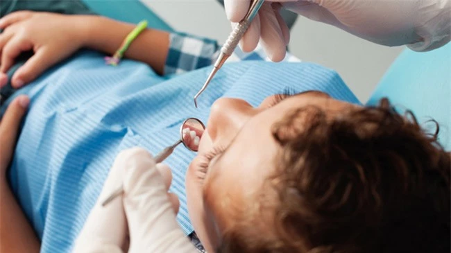 Sâu răng ở trẻ em là gì? Điều trị sâu răng ở trẻ em bằng cách nào? - Ảnh 5.