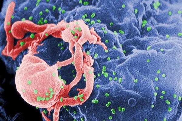   Những virus-1 (HIV-1) được nhìn qua một kính hiển vi điện tử.  