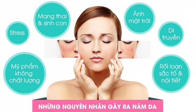 Bị nám da, cứ lấy nắm giá đỗ và củ cải làm thế này sau 2 tuần là sạch bách - Hình 1