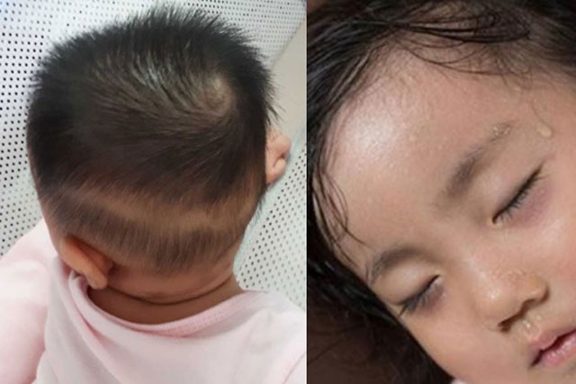 6 dấu hiệu cho thấy trẻ đang thiếu canxi, mẹ lưu ý để bổ sung cho con ngay