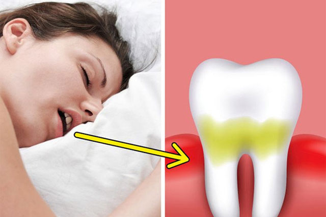 Người có gan xấu thường có 4 biểu hiện trên môi, 'dính' trên 2 cái là cần đi viện gấp