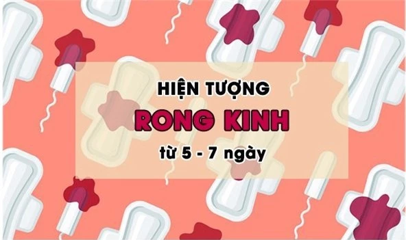 rong-kinh-la-gi