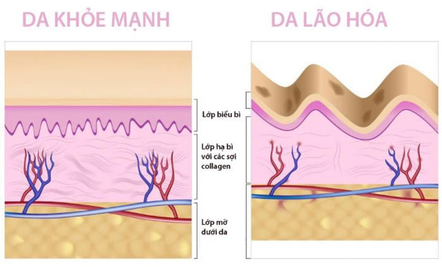 Biện pháp dễ thực hiện giúp làm chậm lão hóa da