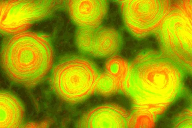 Bất ngờ phát hiện hình ảnh vi khuẩn đột biến đẹp như tranh của Van Gogh