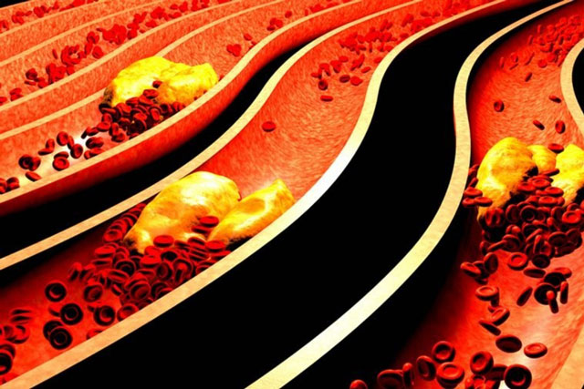 8 lý do bạn nên biết nhóm máu của mình