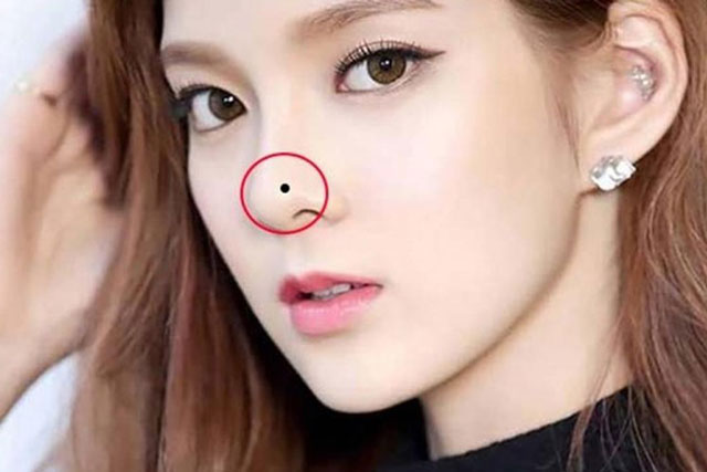 4 nốt ruồi phú quý 'lộc lá' quanh năm nên giữ lại, 3 nốt ruồi tán lộc xui xẻo vạn phần cần xóa đi