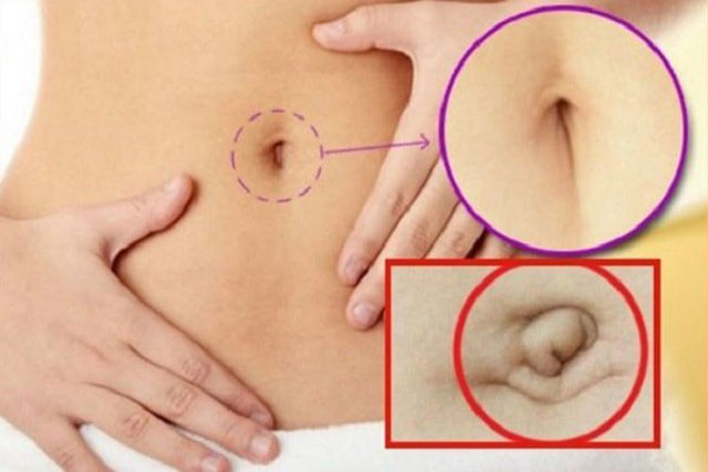 Nhìn tướng rốn 5 giây biết tương lai thành công hay thất bại? Tướng rốn lồi cả đời lận đận, tiền bạc khó giữ