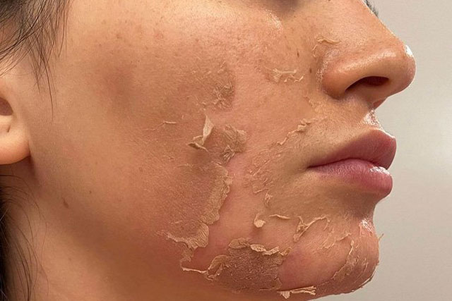 Những điểm cần lưu ý khi tự chăm sóc da tại nhà giúp mang lại hiệu quả như ý